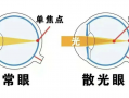 散光眼镜晚上带怎么样，散光眼镜戴久了会有什么影响